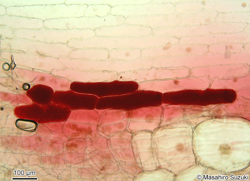 赤タマネギの表皮細胞