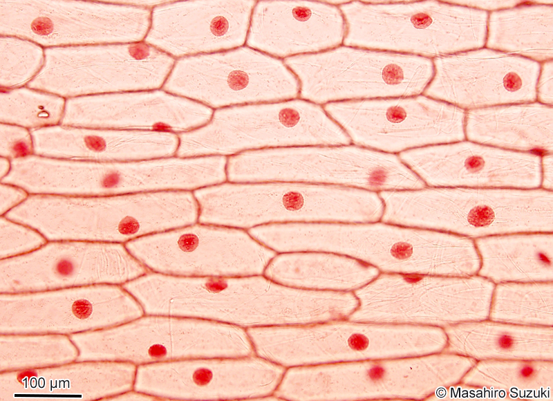 酢酸オルセイン溶液で染色したタマネギの表皮細胞