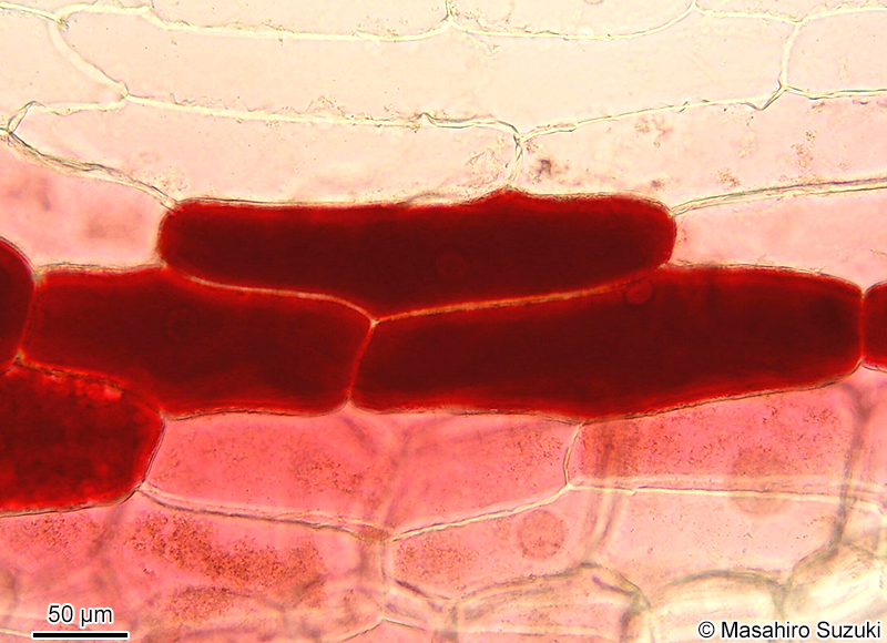 赤タマネギの表皮細胞