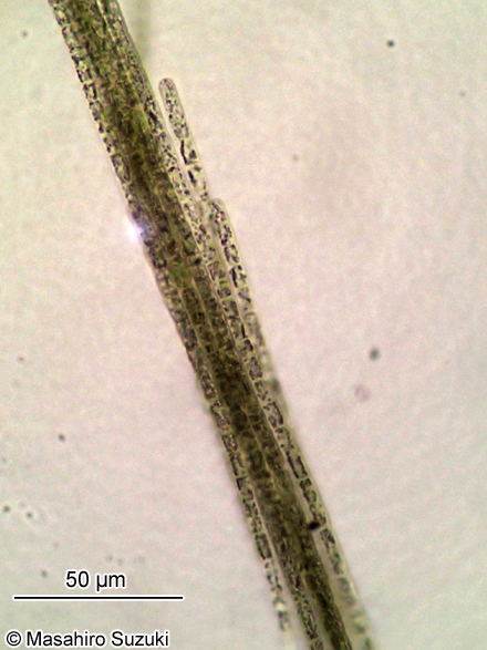 Aphanizomenon flosaquae