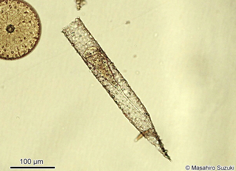 ホソスナカラムシ Tintinnopsis radix