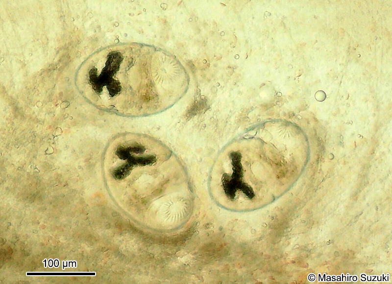 後睾吸虫目 Opisthorchiidaのメタセルカリア