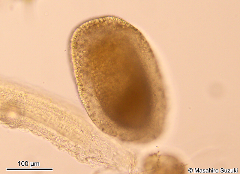 プラヌラ幼生 Planula larva
