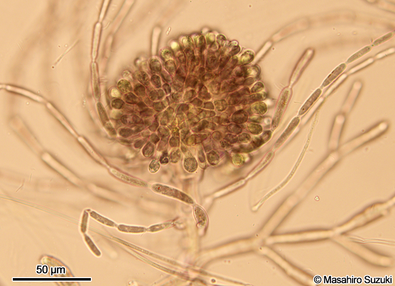 発達した果胞子体