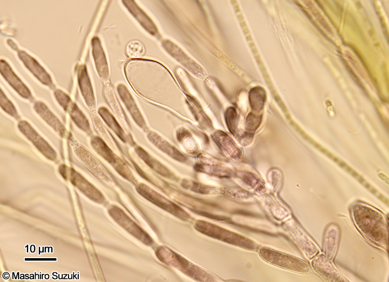 杓子形の受精毛を付けた造果器