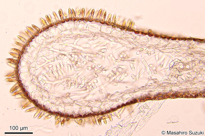 配偶体の横断面