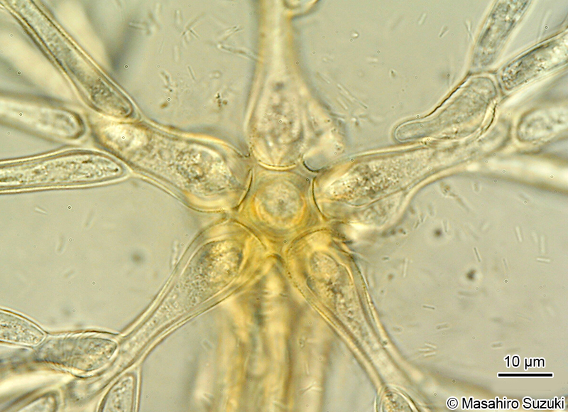 ヤツダカワモズク Sheathia yoshizakiiの輪生枝の基部細胞